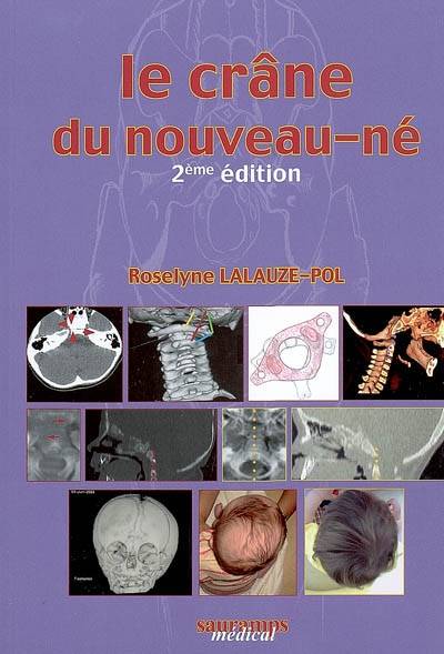 Le crâne du nouveau-né : des contraintes foetales et leurs enjeux neurologiques aux répercussions chez l'adulte | Roselyne Lalauze-Pol, Martine Taver